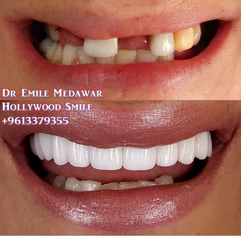 Modern dental clinic in Beirut Lebanon